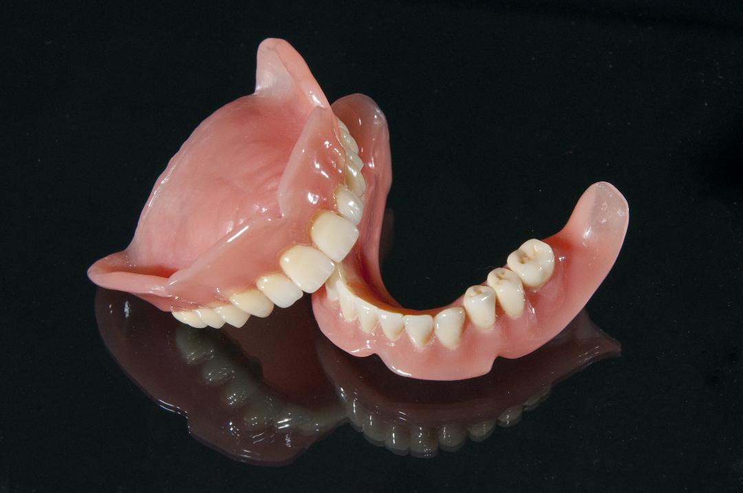 Zahnprothese oberkiefer mit gaumenplatte
